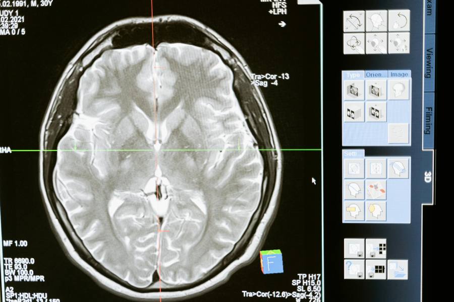 brain injury